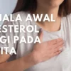 7 Gejala Awal Kolesterol Tinggi pada Wanita, Apa Saja?