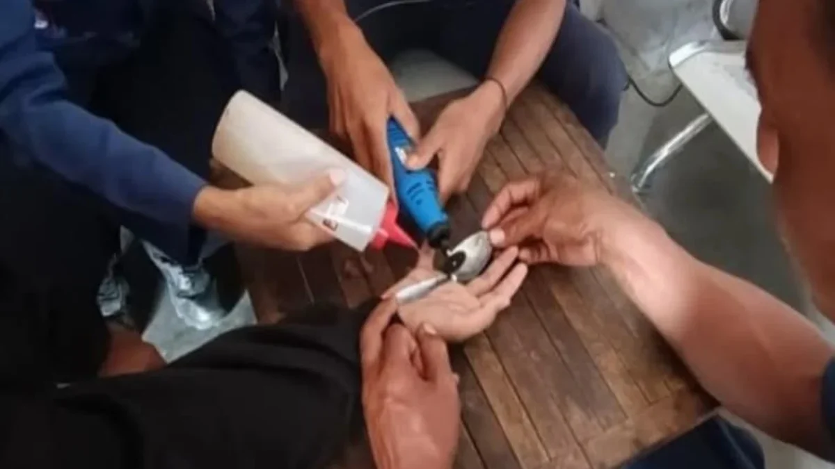 Petugas Damkar Garut bantu lepas cincin yang sulit dilepas (istimewa)