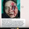 Diduga, Pemuda Asal Cikembar Jadi Korban Pembacokan Geng Motor