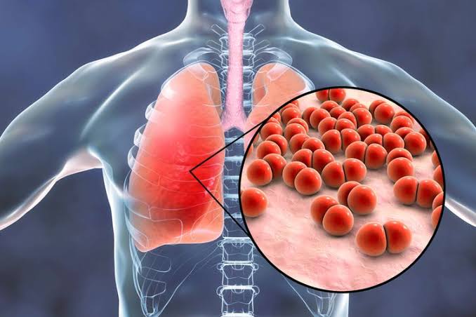 Bakteri Mycoplasma Pneumoniae