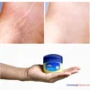 Ampuh dalam Satu Minggu? Cara Menghilangkan Stretch Mark Dengan Vaseline