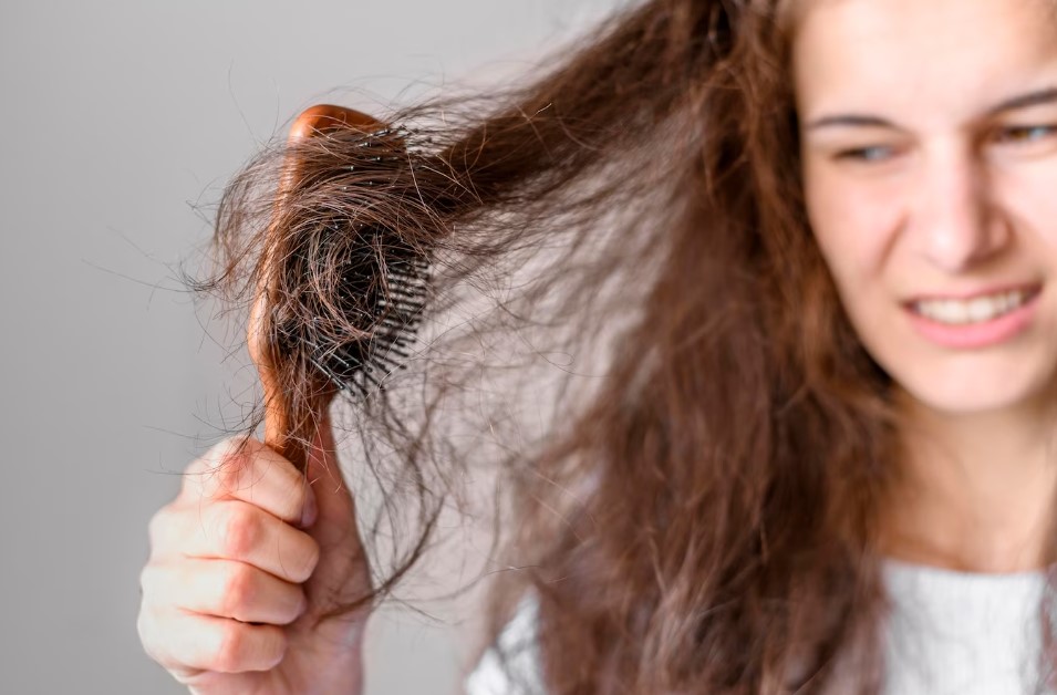 Mengatasi Rambut Rontok Dengan Konsumsi Buah dan Sayuran