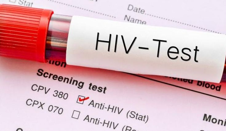 Ribuan Warga Cianjur Mengidap HIV/AIDS