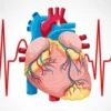 Penyakit Jantung Koroner: Penyumbatan Arteri Coronary yang Merupakan Ancaman Serius