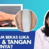 Koreng Mengganggu Penampilan? Begini cara Menghilangkannya