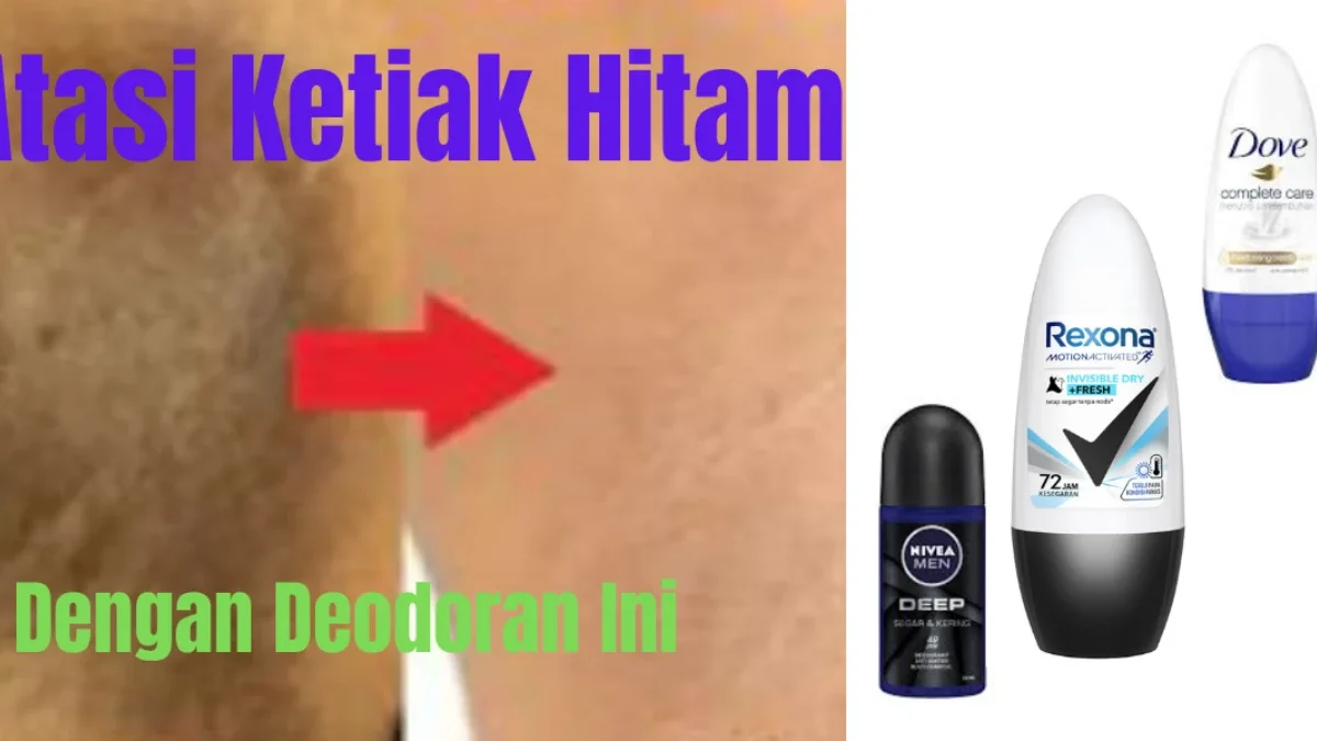 Kamu Tidak Perlu Khawatir Lagi Dengan Ketiak Hitam, Ini 5 Deodoran Paling Ampuh untuk Mengatasi Ketiak Hitam