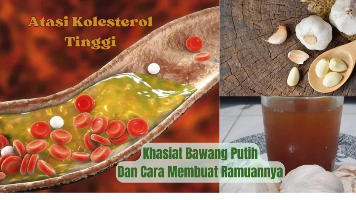 Khasiat Bawang Putih Untuk Kolesterol Tinggi, Berikut Cara Membuat Obat Herbal Untuk Kolesterol Tinggi