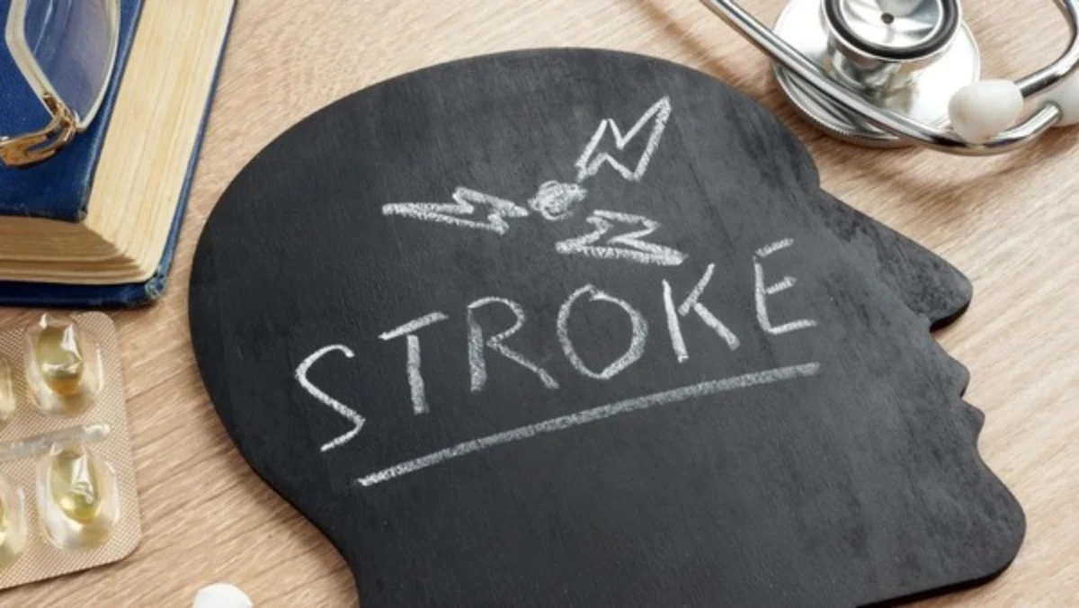 Pencegahan Stroke Sejak Dini, Lakukan Hidup Sehat Demi Kebertahanan Hidup yang Seimbang