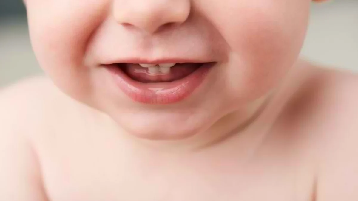 Ciri-ciri dan Perawatan Khusu Natal dan Neonatal Teeth pada Bayi