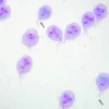 Bebagai Penyakit yang Disebabkan oleh Giardia Lamblia