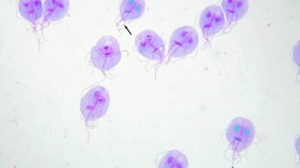 Bebagai Penyakit yang Disebabkan oleh Giardia Lamblia