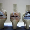 Tujuan dan Indikasi Total Knee Replacement