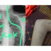 Viral, Seorang Siswa Kelas 1 MTs Alami Kekerasan Dari 16 Seniornya Sampai Alami Patah Tulang