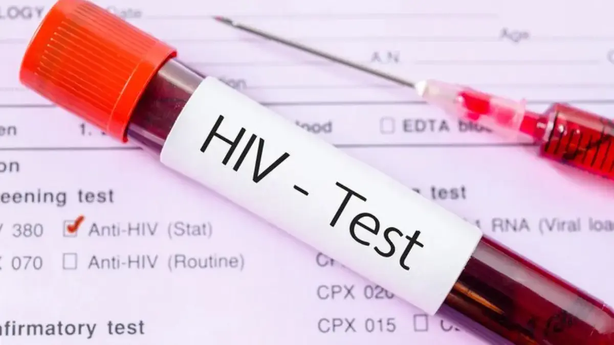 GONG! 30 Orang Dari 75 Orang Peserta Seks Sesama Jenis Dinyatakan Reaktif HIV!