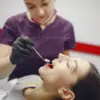 Lebih dari Sekadar Bersih, Ini Manfaat Scaling Gigi untuk Kesehatan Mulut Tubuh