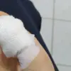 Langkah Tepat Menangani Luka Tangan Akibat Kaca di Rumah