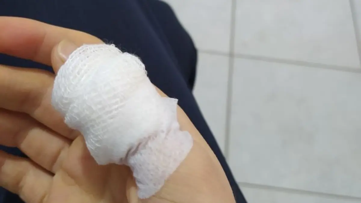 Langkah Tepat Menangani Luka Tangan Akibat Kaca di Rumah