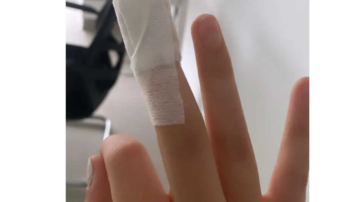 Waspada! Begini Cara Tepat Menangani Luka di Tangan Akibat Kaca