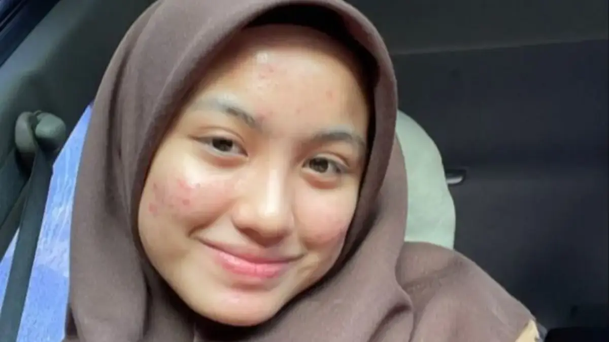 5 Kandungan Skincare yang Wajib Ada untuk Pejuang Jerawat, Nomor 4 Sering Terlewat!