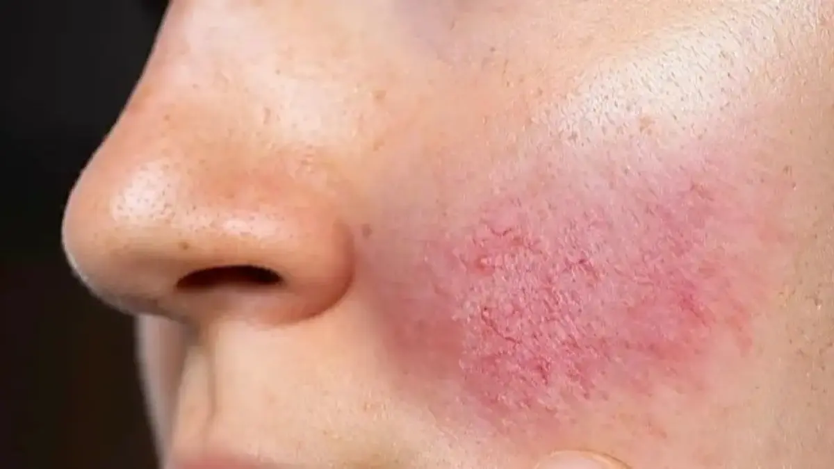 Makeup Simple untuk Kulit Sensitif: Bedak Non-Comedogenic yang Nyaman Dipakai Seharian Makeup Simple untuk Kulit Sensitif: Bedak Non-Comedogenic yang Nyaman Dipakai Seharian