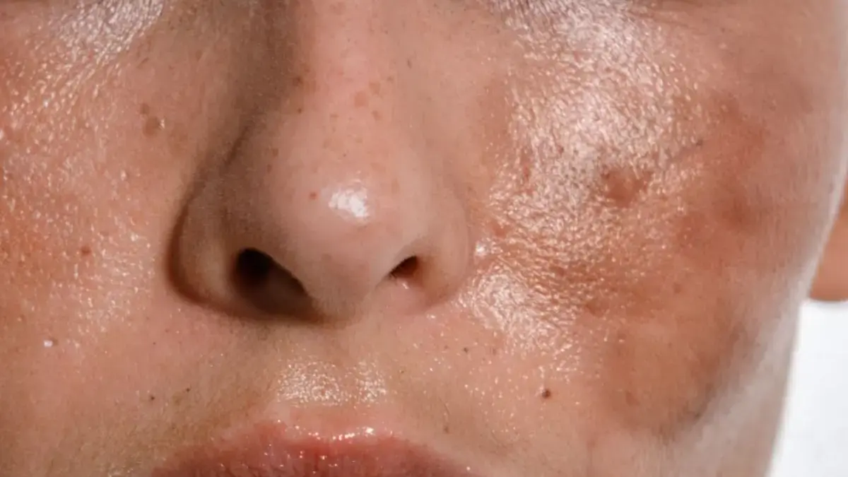 Kulit Kusam & Berminyak? AGB Active Glow Booster Serum Solusi Skin Barrier & Anti Aging