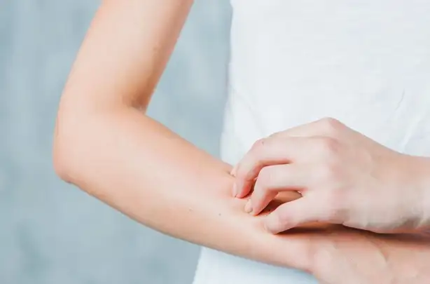 Kulit Kering dan Kusam? Tidak Perlu Khawati, Cukup Rutin Pakai Ini