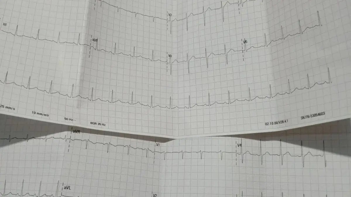 Warga Rancaekek Jalani Perawatan Jantung, Tiga Kali Laporan PLN Belum Merespons